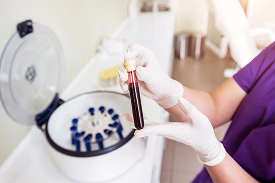  prp hair treatment